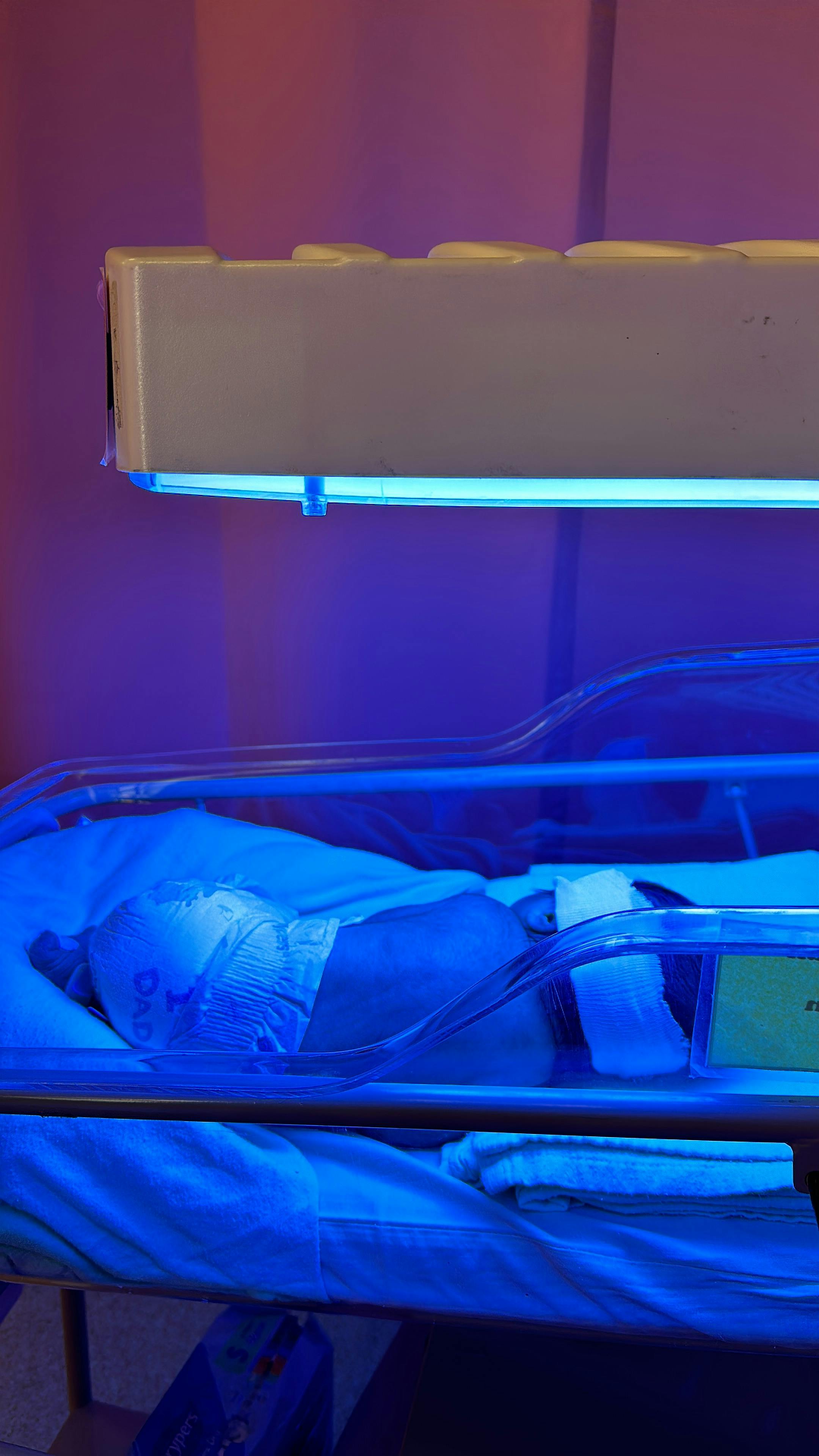 Your Baby Looks Yellow? Here's What's Actually Going On